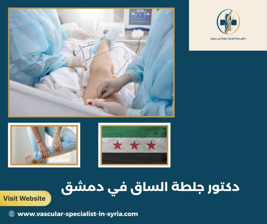 دكتور جلطة الساق في دمشق دكتور جلطة الساق في دمشق