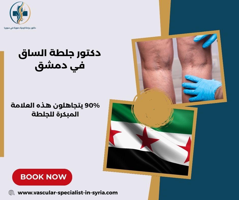 دكتور جلطة الساق في دمشق