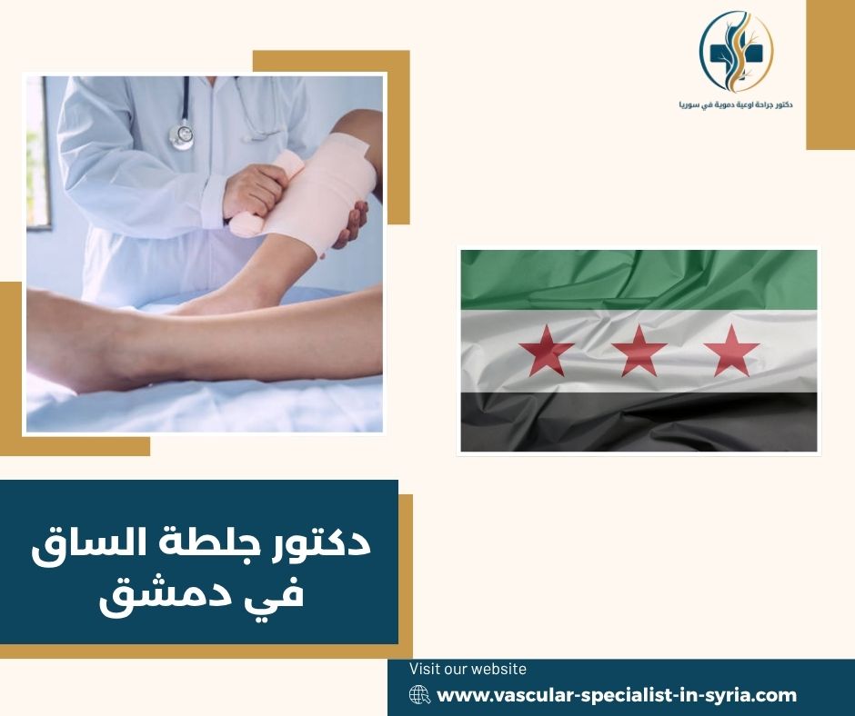 الفرق بين الجلطة السطحية والجلطة الوريدية العميقة الفرق بين الجلطة السطحية والجلطة الوريدية العميقة