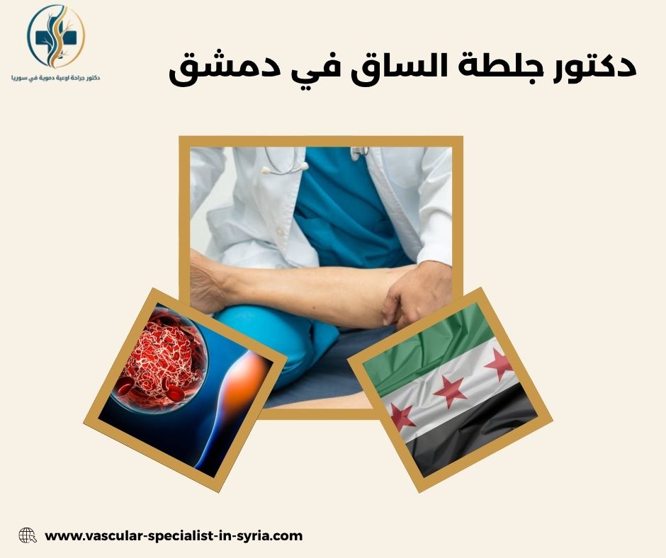دكتور جلطة الساق في دمشق دكتور جلطة الساق في دمشق