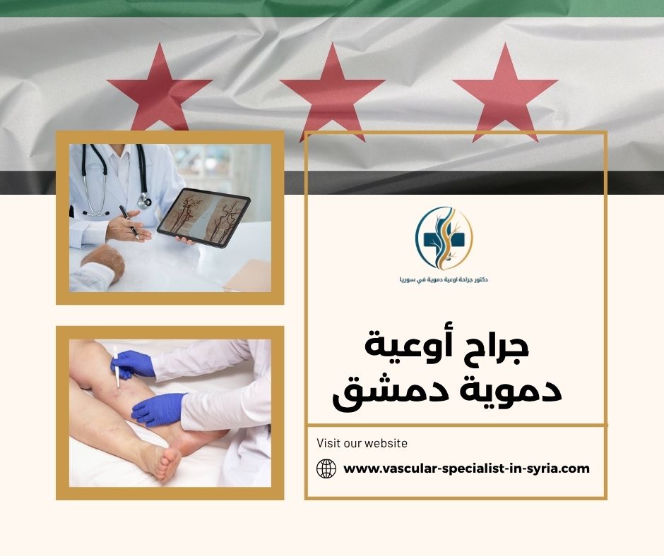 جراح أوعية دموية دمشق