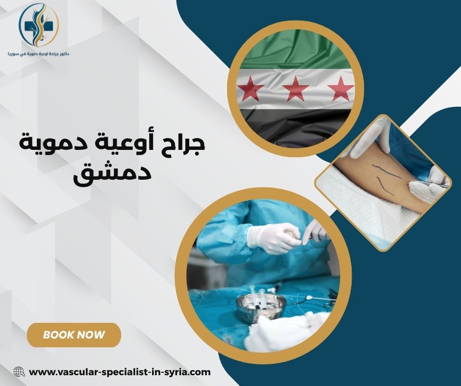 جراح أوعية دموية دمشق