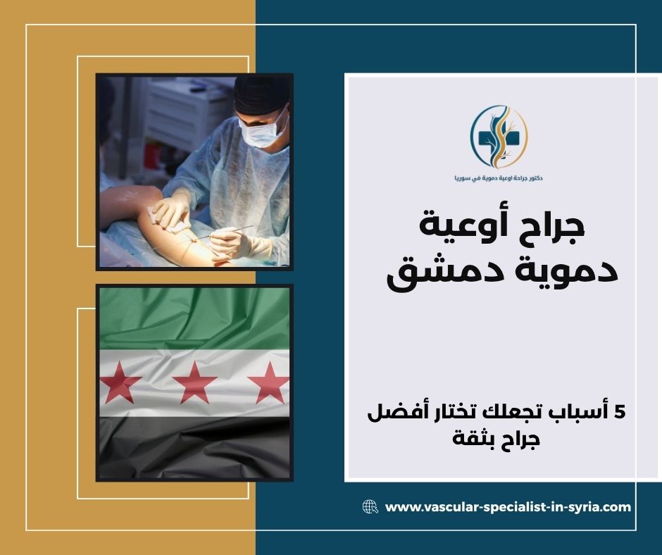 جراح أوعية دموية دمشق