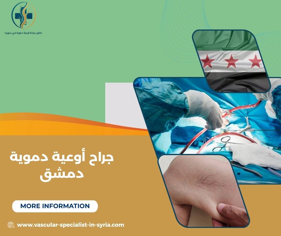 ما الفرق بين جراح الأوعية وطبيب الأوعية؟
