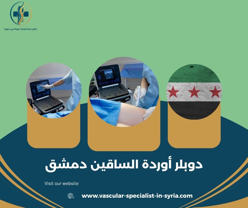 دوبلر أوردة الساقين دمشق دوبلر أوردة الساقين دمشق
