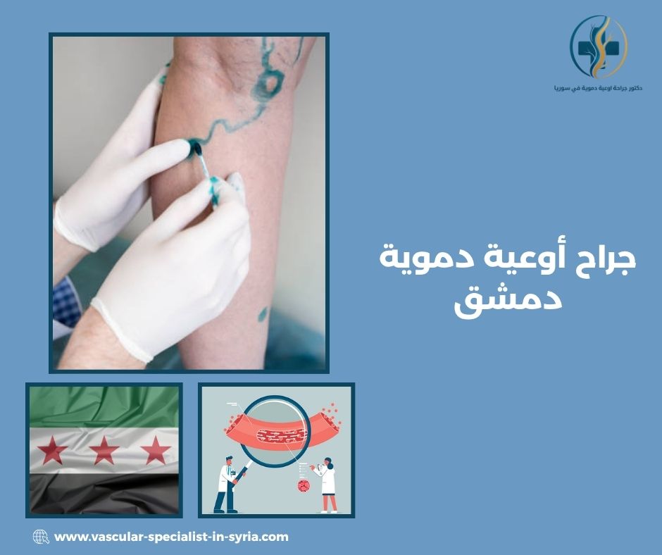 علامات نقص التروية في القدمين والساقين