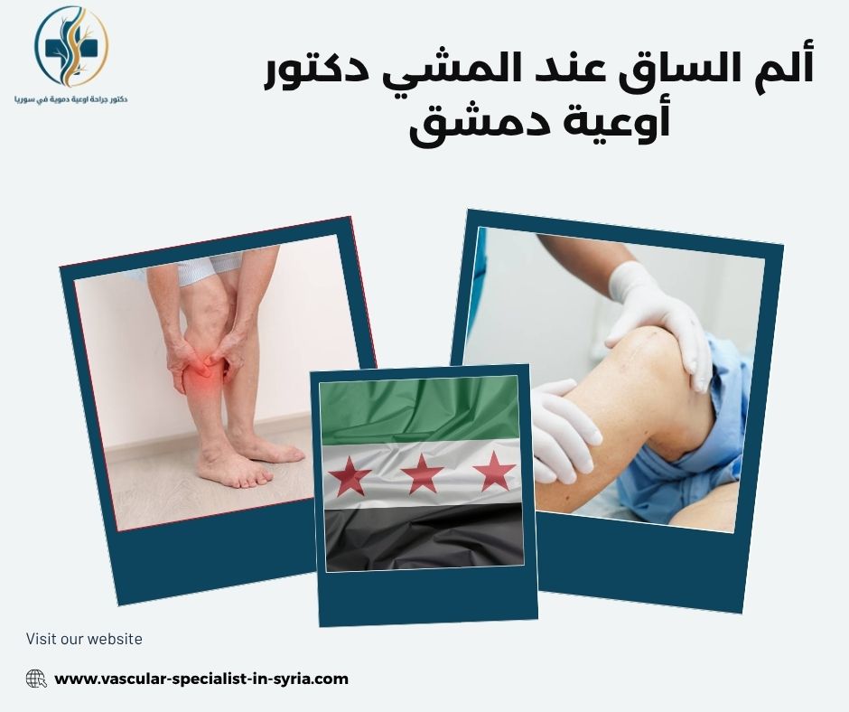الفرق بين ألم العضلات وألم نقص التروية الفرق بين ألم العضلات وألم نقص التروية