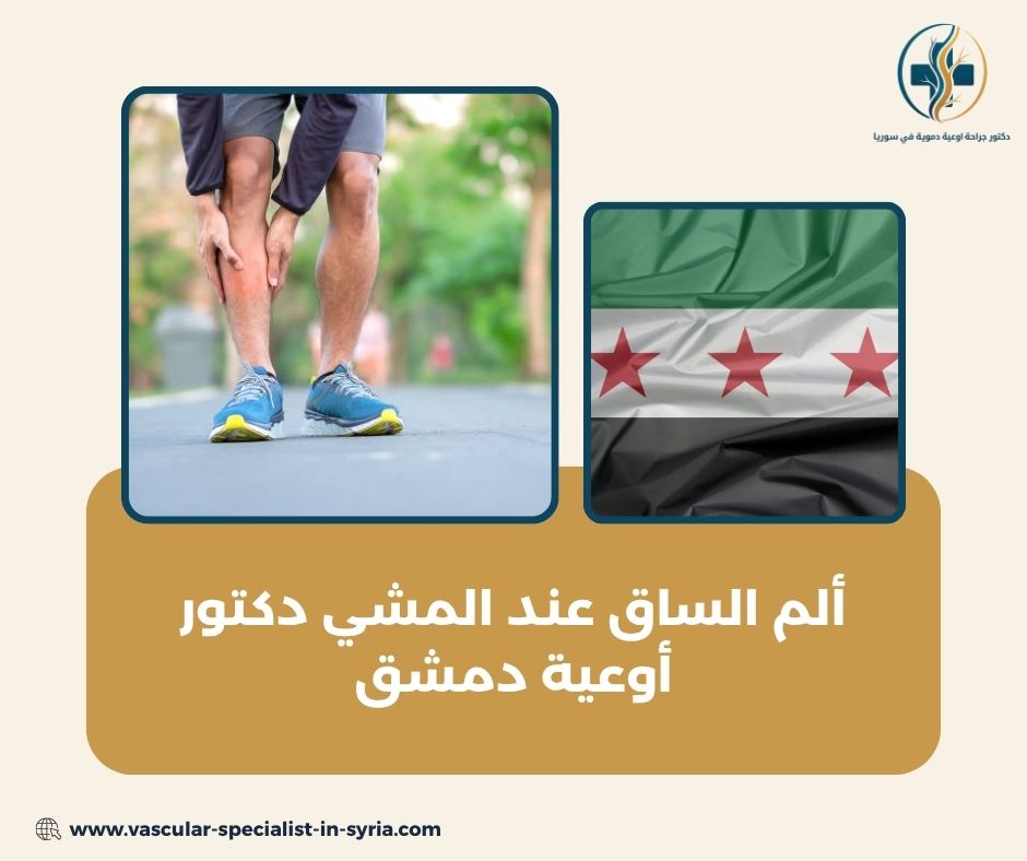 ما المقصود بألم الساق عند المشي؟ ما المقصود بألم الساق عند المشي؟
