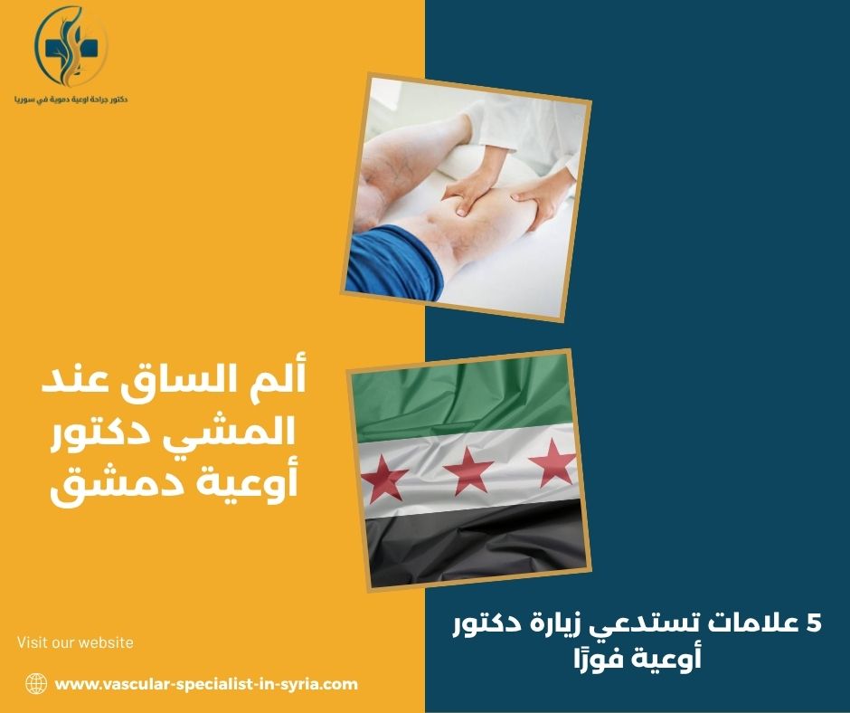 ألم الساق عند المشي دكتور أوعية دمشق