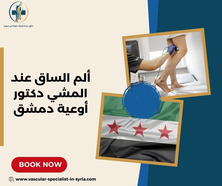 ألم الساق عند المشي دكتور أوعية دمشق