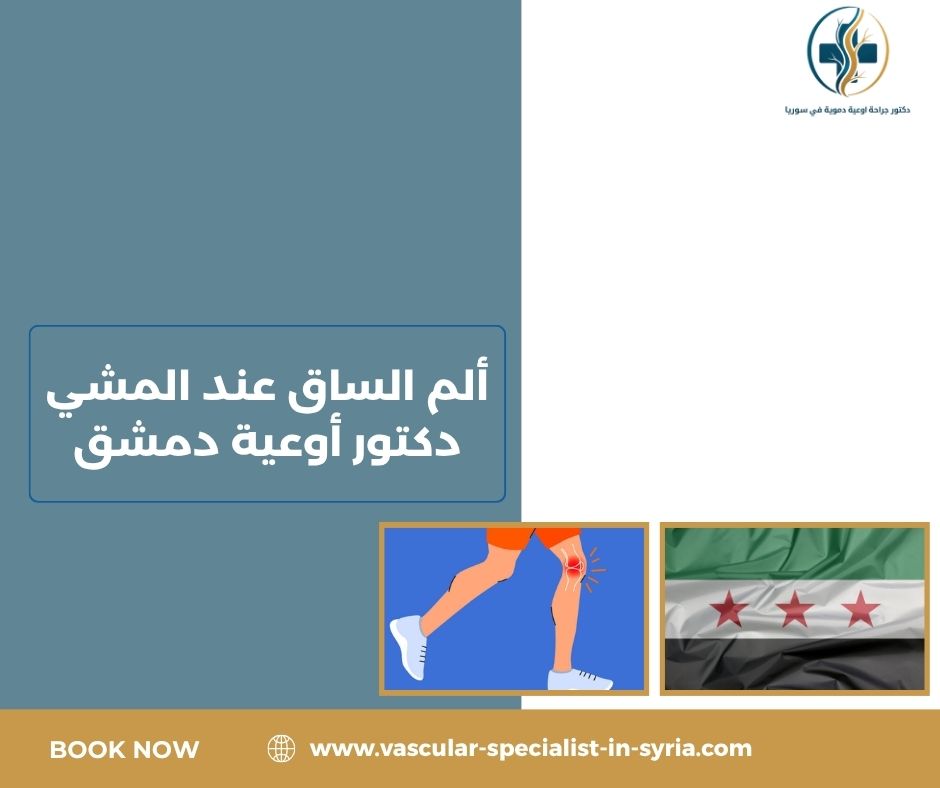 ألم الساق عند المشي دكتور أوعية دمشق ألم الساق عند المشي دكتور أوعية دمشق