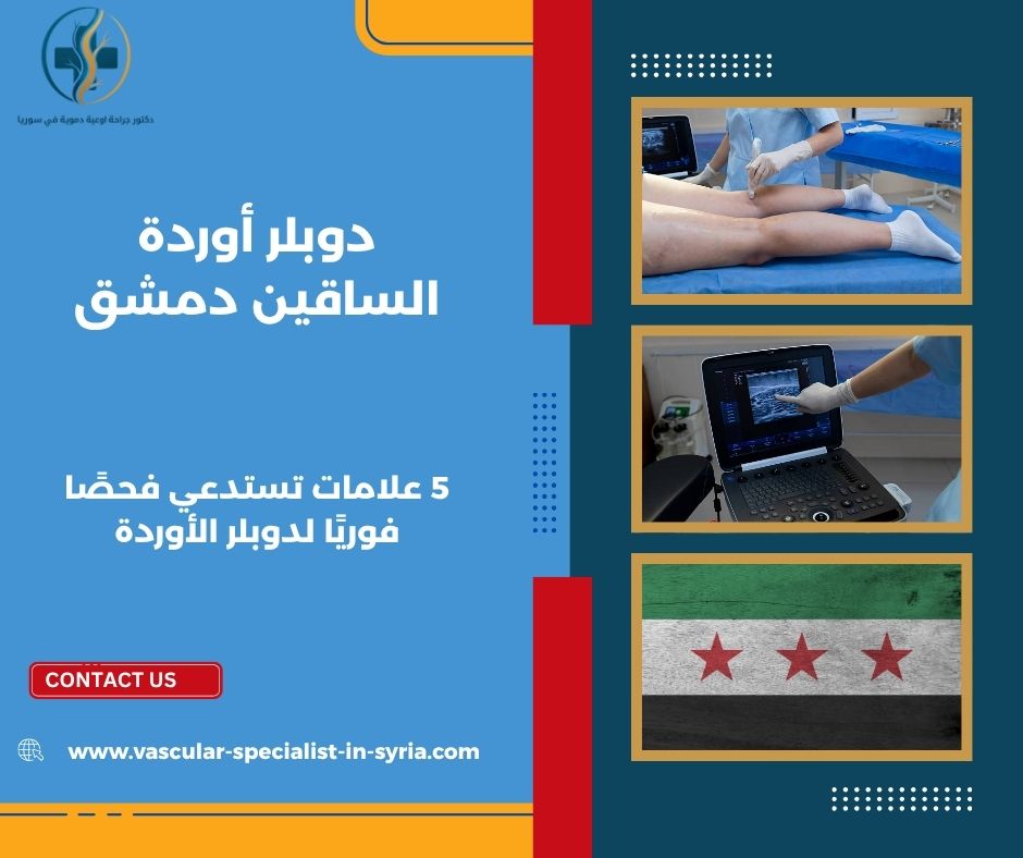 دوبلر أوردة الساقين دمشق