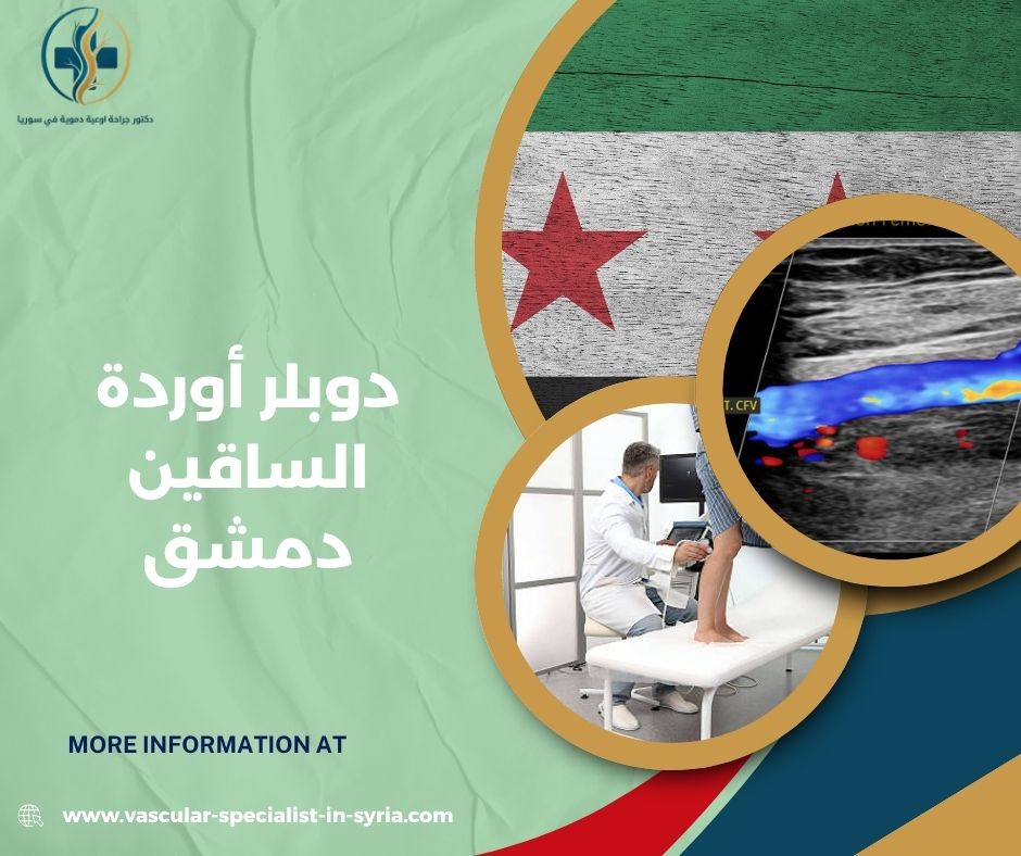 ماالذي يكشفه دوبلر الأوردة و لا يكشفه؟ ماالذي يكشفه دوبلر الأوردة و لا يكشفه؟