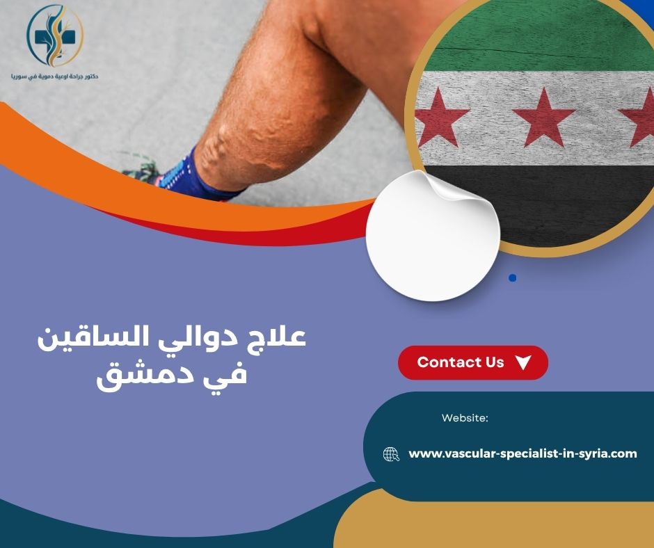 علاج دوالي الساقين في دمشق علاج دوالي الساقين في دمشق