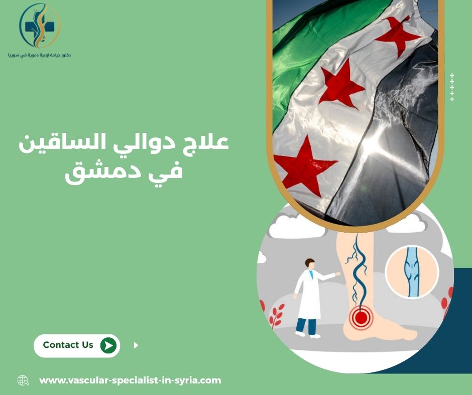 متى نحتاج إلى علاج دوالي الساقين في دمشق؟ متى نحتاج إلى علاج دوالي الساقين في دمشق؟