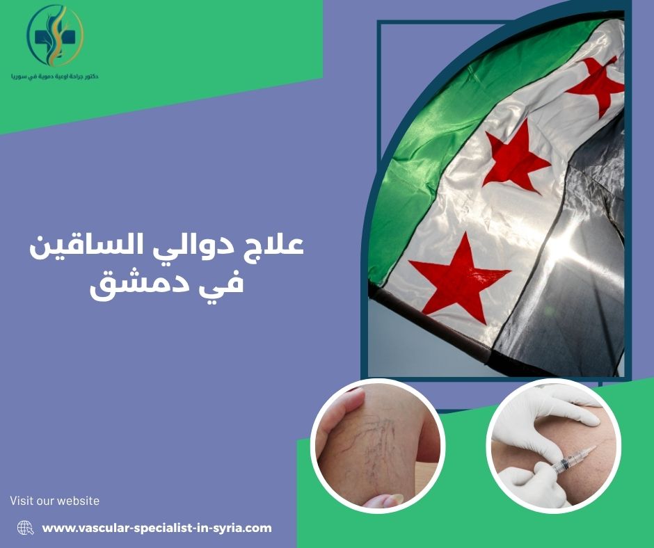 الفرق بين الدوالي الظاهرة والقصور الوريدي الفرق بين الدوالي الظاهرة والقصور الوريدي