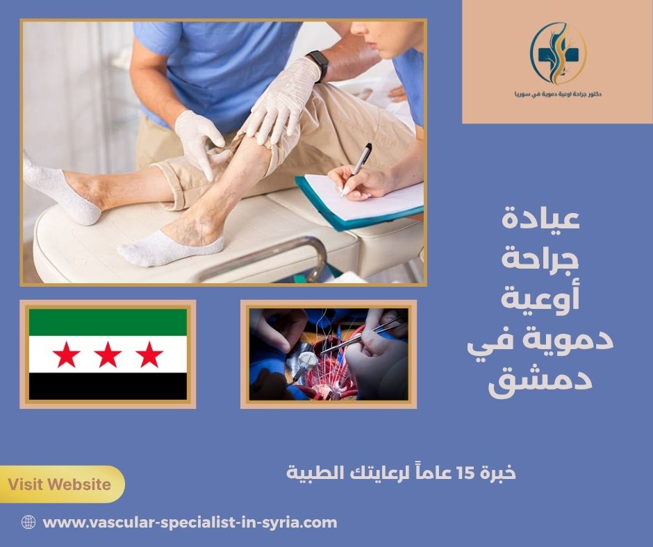 عيادة جراحة أوعية دموية في دمشق