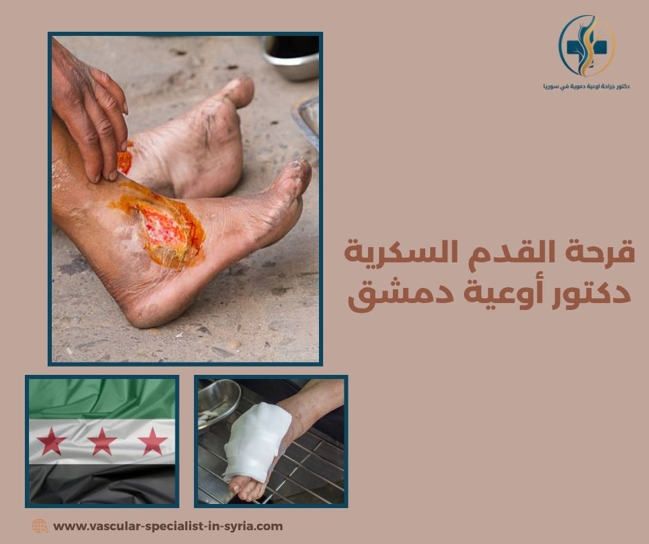 علامات العدوى أو نقص التروية التي تستدعي الطوارئ علامات العدوى أو نقص التروية التي تستدعي الطوارئ