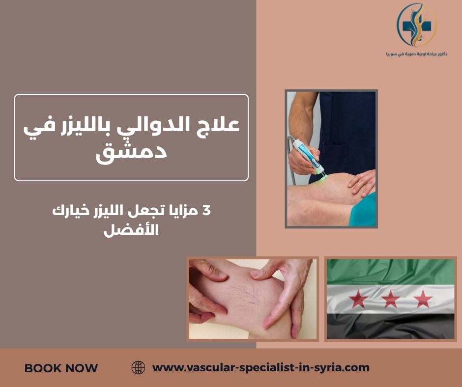 علاج الدوالي بالليزر في دمشق