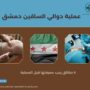 عملية دوالي الساقين دمشق