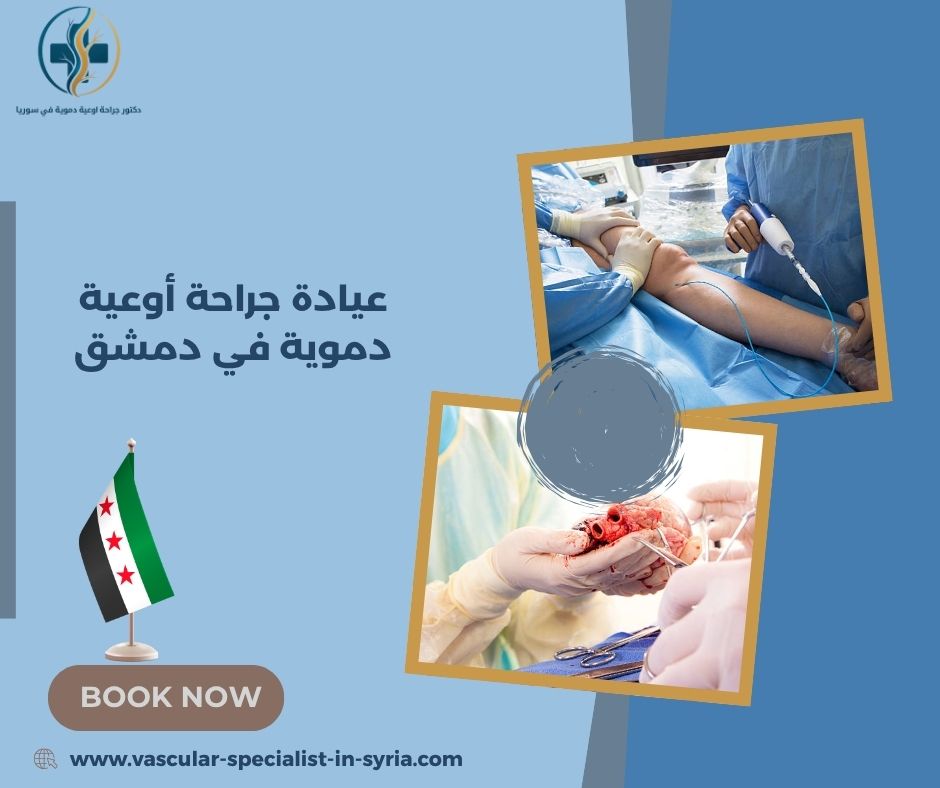 عيادة جراحة أوعية دموية في دمشق عيادة جراحة أوعية دموية في دمشق