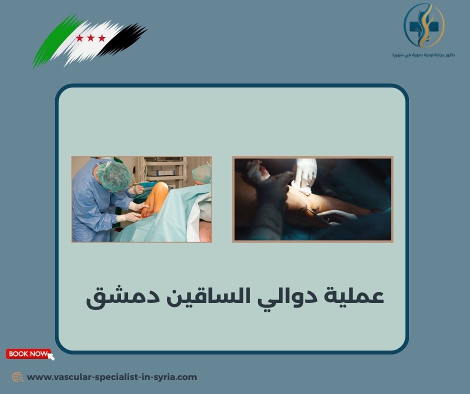 التعافي والمتابعة بعد علاج الدوالي التعافي والمتابعة بعد علاج الدوالي