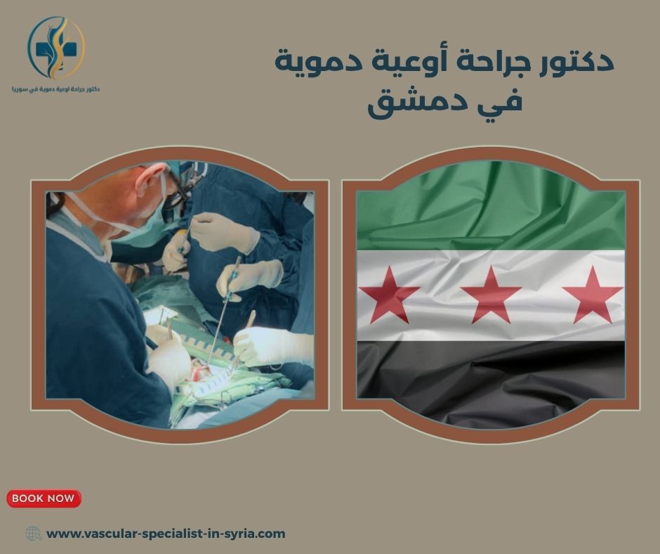 ما الحالات التي يعالجها جراح الأوعية الدموية؟ ما الحالات التي يعالجها جراح الأوعية الدموية؟