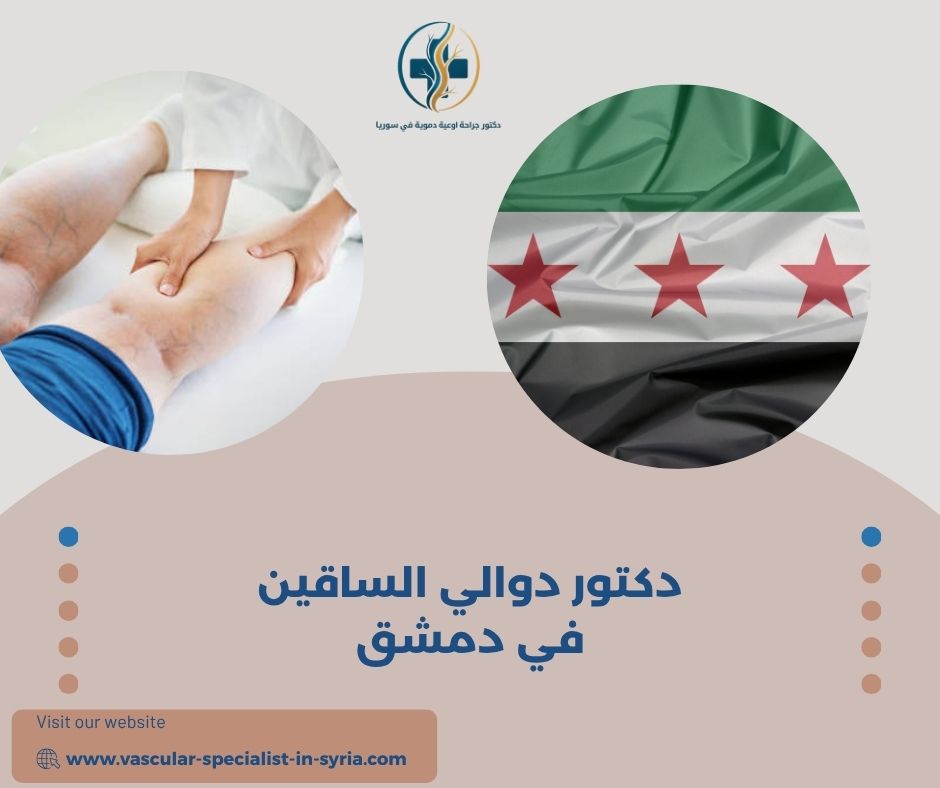 دكتور دوالي الساقين في دمشق دكتور دوالي الساقين في دمشق