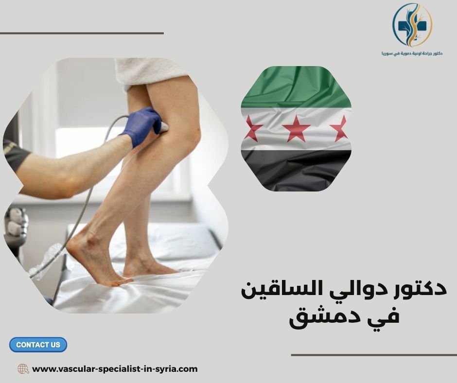 دكتور دوالي الساقين في دمشق دكتور دوالي الساقين في دمشق