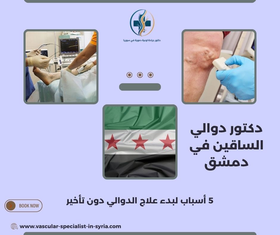 دكتور دوالي الساقين في دمشق