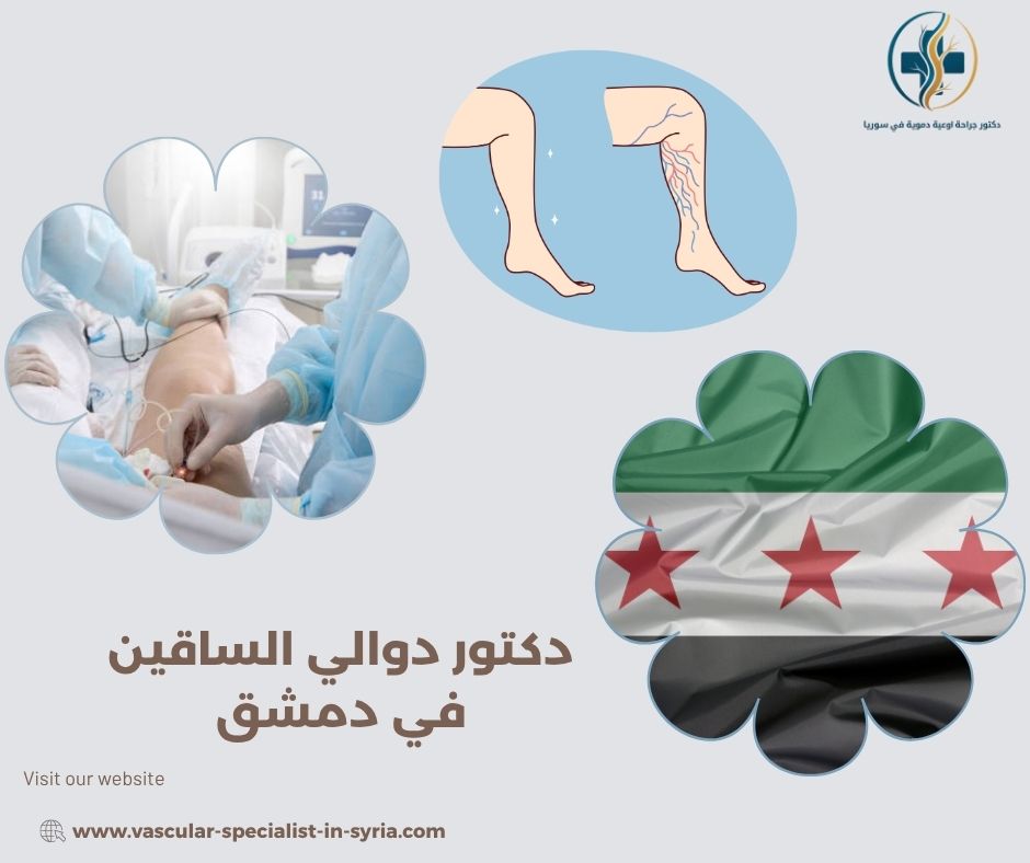 متى تكون الدوالي مرتبطة بجلطات أو قصور وريدي؟ متى تكون الدوالي مرتبطة بجلطات أو قصور وريدي؟