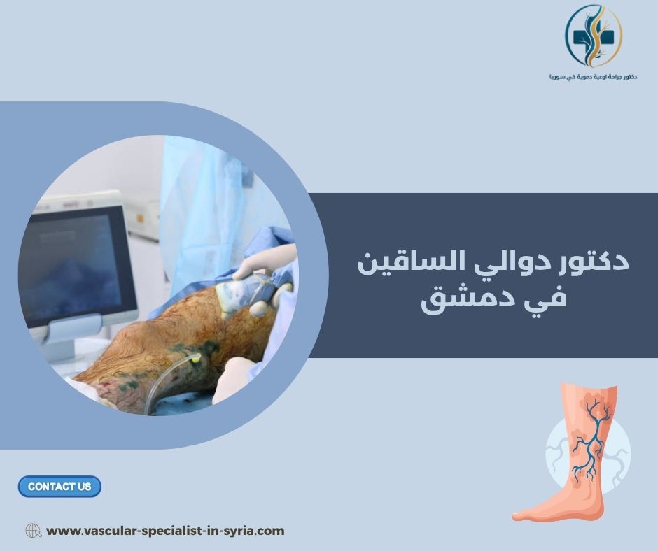 علاج الدوالي للرجال والنساء: ما الذي يختلف؟ علاج الدوالي للرجال والنساء: ما الذي يختلف؟