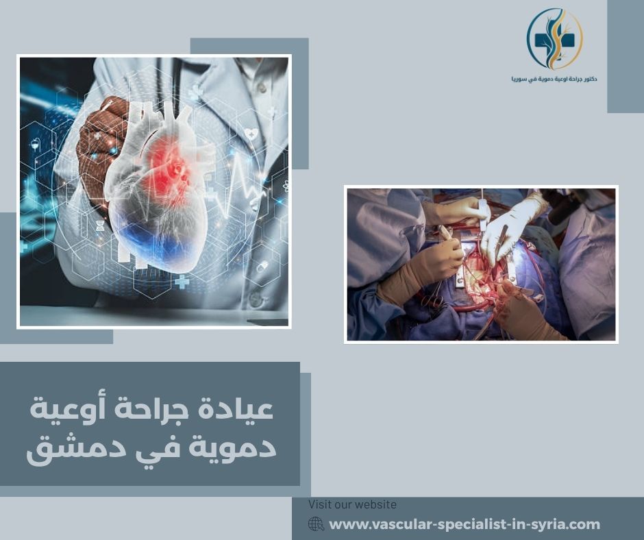 عيادة جراحة أوعية دموية في دمشق عيادة جراحة أوعية دموية في دمشق