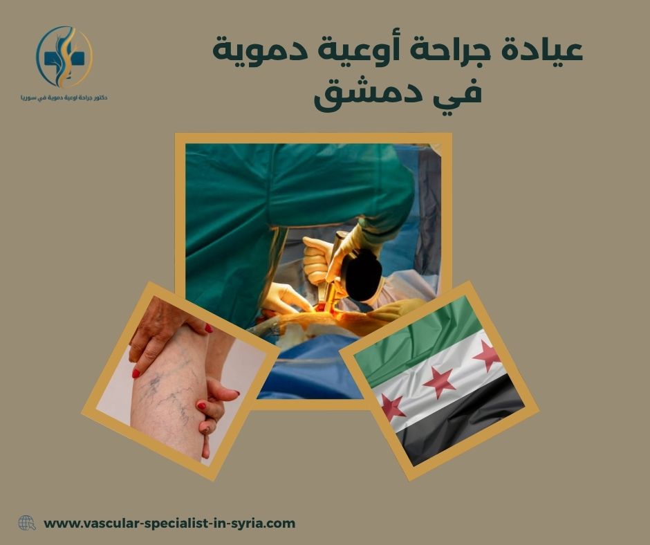 عيادة جراحة أوعية دموية في دمشق عيادة جراحة أوعية دموية في دمشق