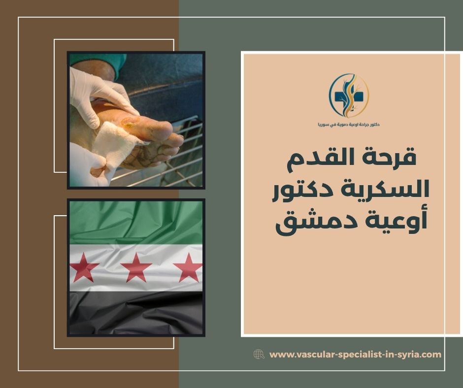 لماذا لا تلتئم بعض جروح القدم عند مرضى السكري؟ لماذا لا تلتئم بعض جروح القدم عند مرضى السكري؟