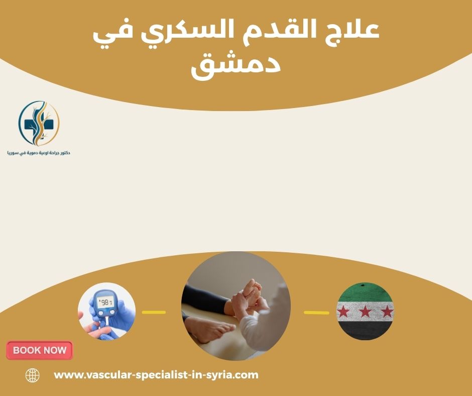 فحص تروية القدم لدى مرضى السكري فحص تروية القدم لدى مرضى السكري
