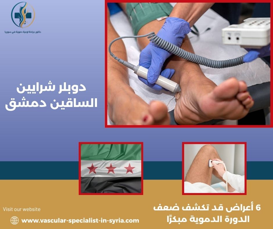 دوبلر شرايين الساقين دمشق