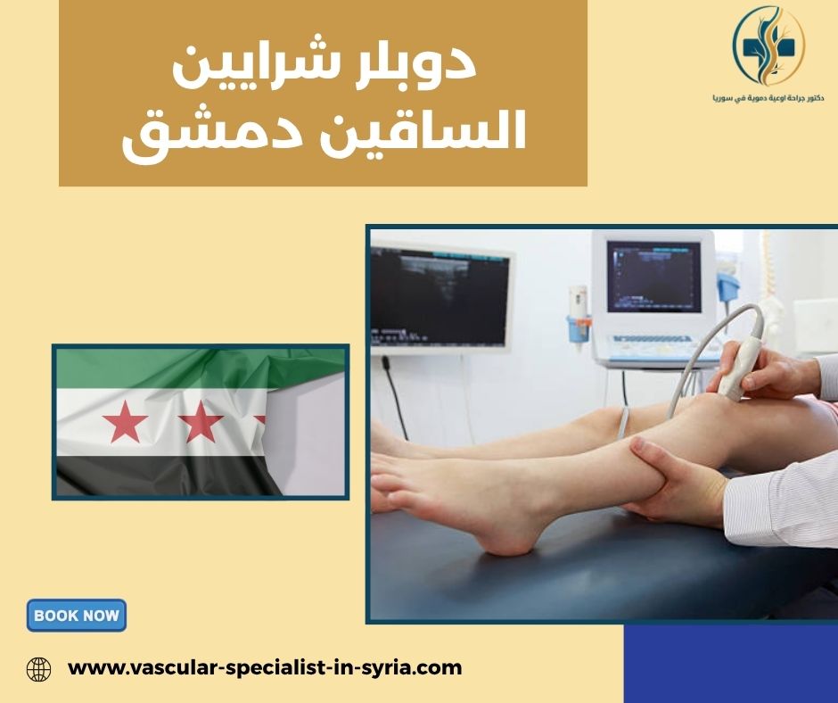 ما الذي يوضحه دوبلر شرايين الساقين؟