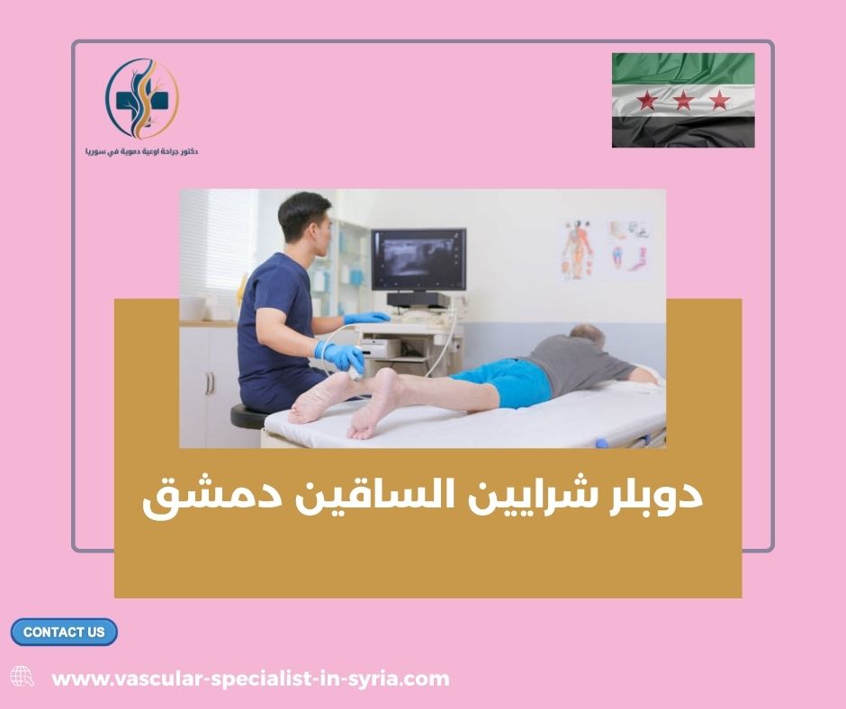 دوبلر شرايين الساقين دمشق
