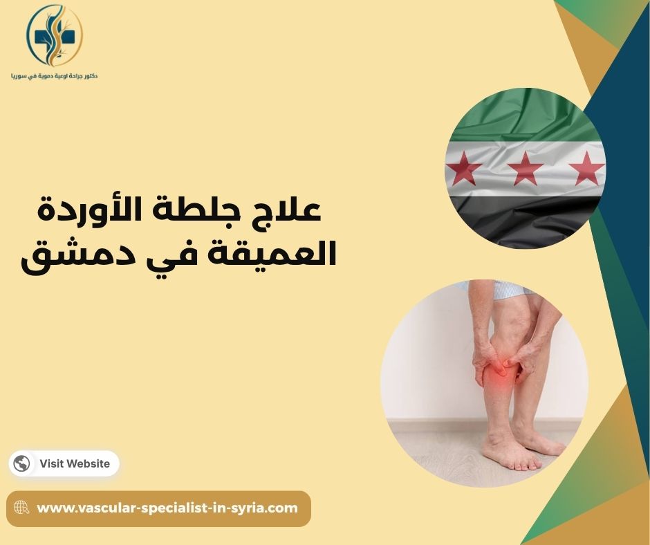 متى تحتاج الجلطة الوريدية إلى رعاية عاجلة؟ متى تحتاج الجلطة الوريدية إلى رعاية عاجلة؟