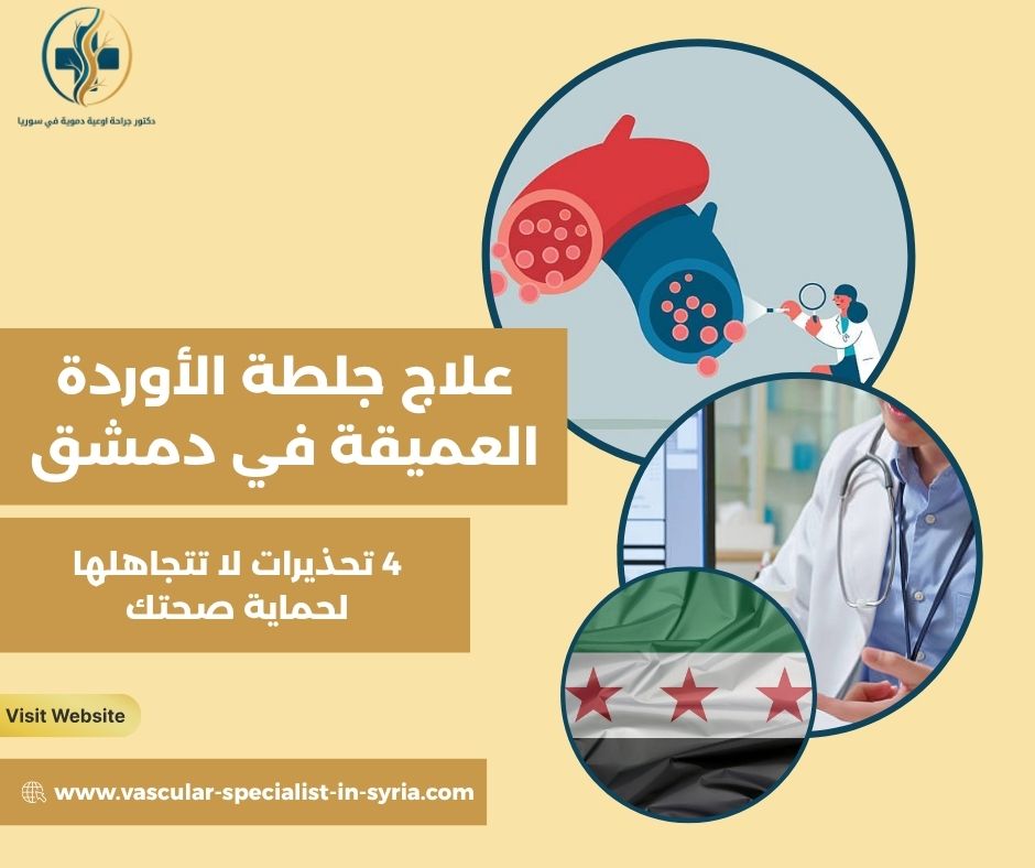 علاج جلطة الأوردة العميقة في دمشق