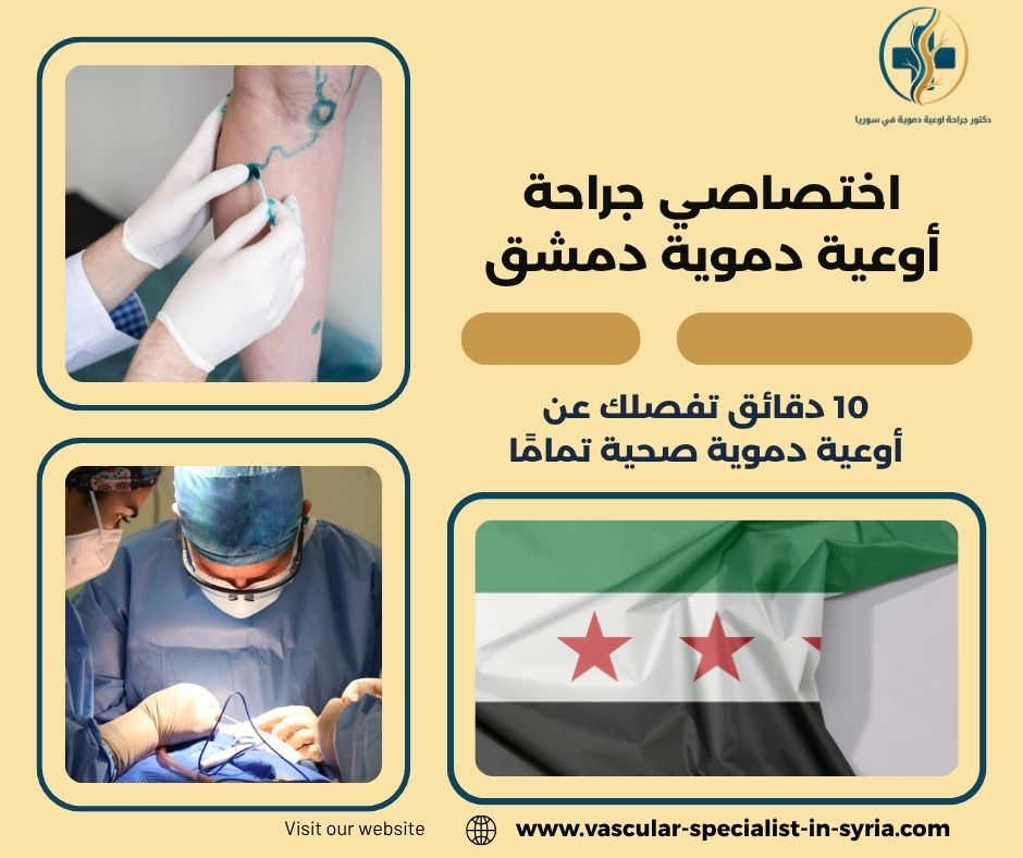 اختصاصي جراحة أوعية دموية دمشق