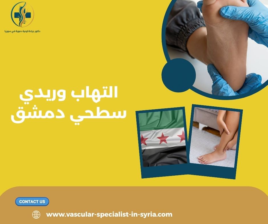 الفرق بين التهاب الوريد السطحي والجلطة العميقة الفرق بين التهاب الوريد السطحي والجلطة العميقة