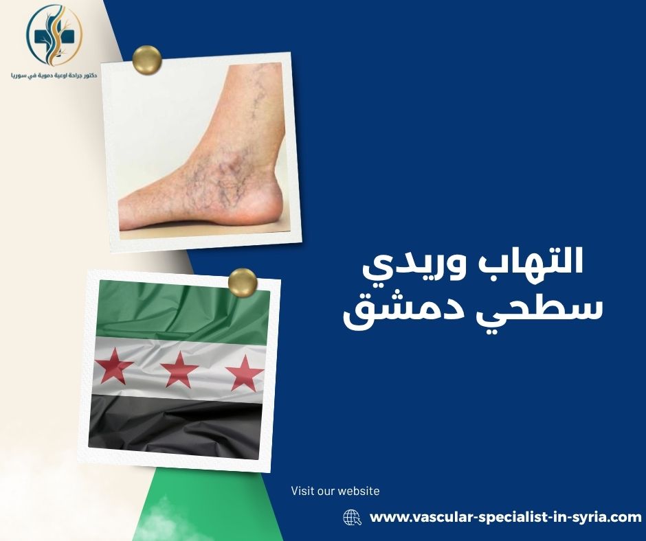 احمرار وألم على مسار الوريد في الساق احمرار وألم على مسار الوريد في الساق