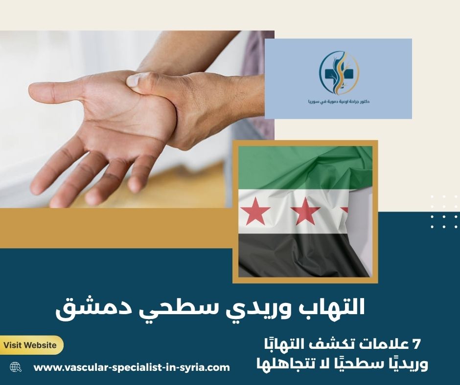 التهاب وريدي سطحي دمشق