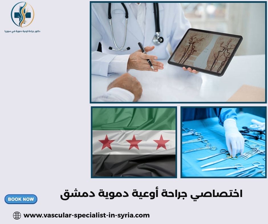 اختصاصي جراحة أوعية دموية دمشق اختصاصي جراحة أوعية دموية دمشق