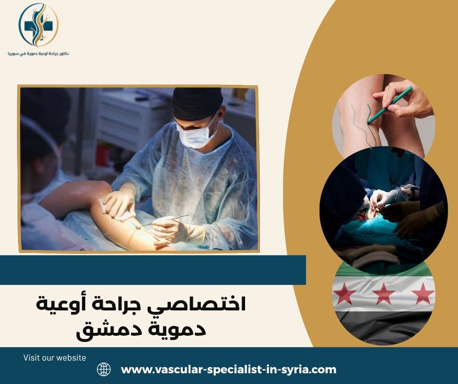 اختصاصي جراحة أوعية دموية دمشق اختصاصي جراحة أوعية دموية دمشق