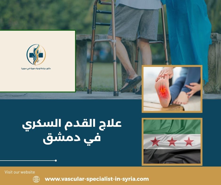 علاج القدم السكري في دمشق علاج القدم السكري في دمشق