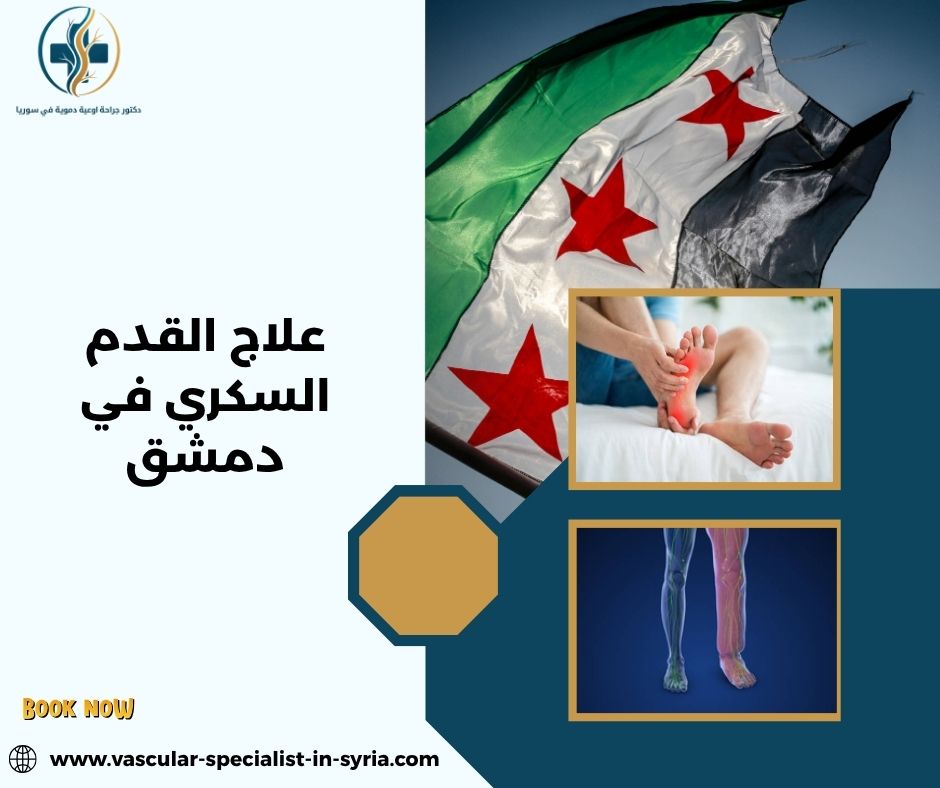 علاج القدم السكري في دمشق علاج القدم السكري في دمشق