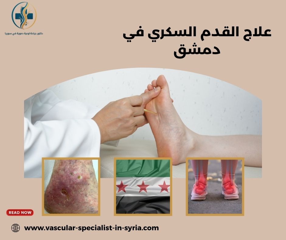 دور جراح الأوعية في تقييم القدم السكري دور جراح الأوعية في تقييم القدم السكري